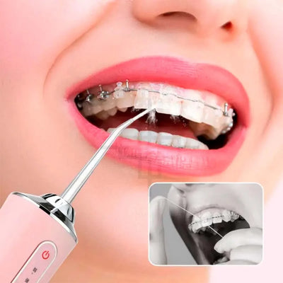 Portable Dental Oral Irrigator, USB Rechargeable, Cleaning nozzle, Strong Jet, 220ml